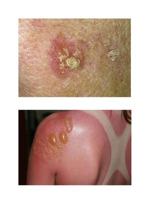 Documento Sin Título Documentos De Google