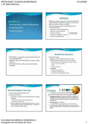 Hernias Pared Abdominal