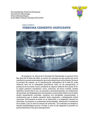 Fibroma Cemento Osificante