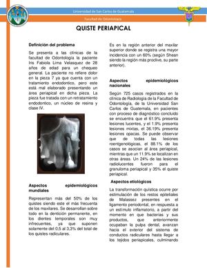 Quiste Periapical