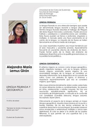 Lengua Fisurada y Geografica