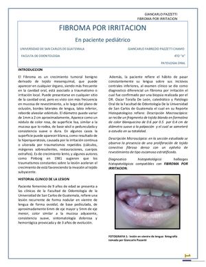 Fibroma Por Irritación 2019