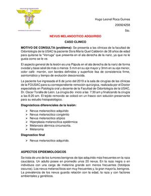 Nevus Melanocitico Adquirido