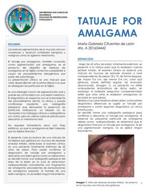 Tatuaje Por Amalgama