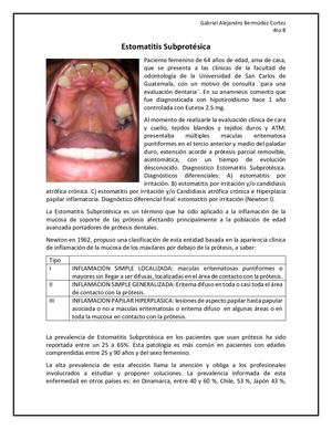Estomatitis Subprotésica (newton I)
