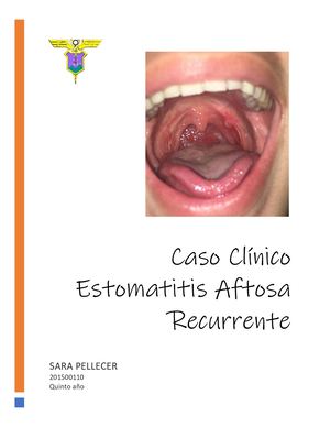 Úlcera en Arco Palatogloso Izquierdo