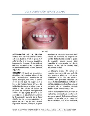 Quiste De Erupción Pdf