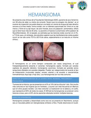 Hemangioma