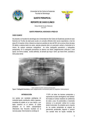 Quiste Periapical Patología