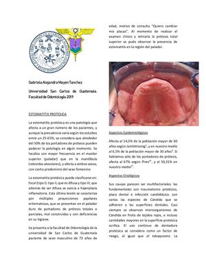 Estomatitis Prótesica