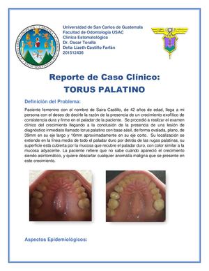 Torus Palatino Patología