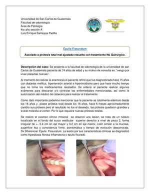 Épulis Fissuratum Asociado A Prótesis Total Mal Ajustada