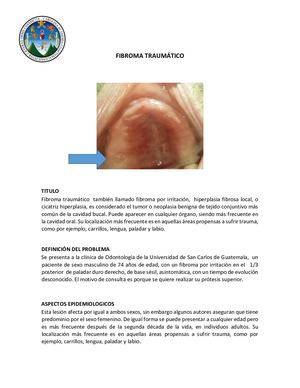 Fibroma Traumático Docx Caso Clinico 2019