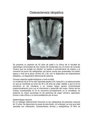Osteosclerosis Idiopática