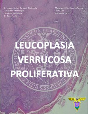 Leucoplasia Verrucosa Proliferativa Docx