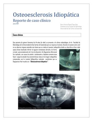 Osteoesclerosis Idiopàtica