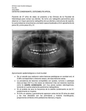 Osteitis Condensante, Orlinten Umaña, 5to Año