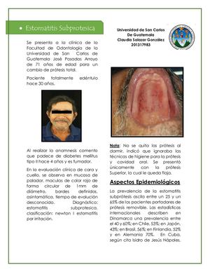 Estomatitis subprotesica