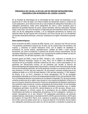 Presencia De Celdilla De Haller En Región Infraorbitaria Izquierda