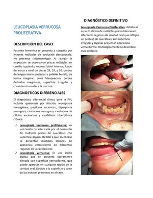 Leucoplasia Verrucosa Proliferativa