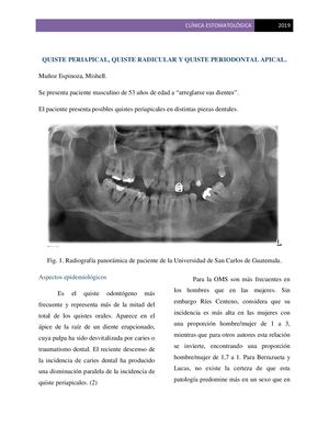 Quiste Periapical, Muñoz M
