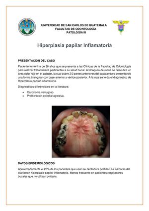 Hiperplasia papilar inflamatoria