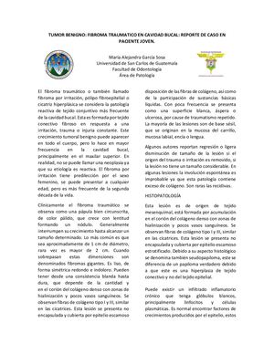 Fibroma Bucal
