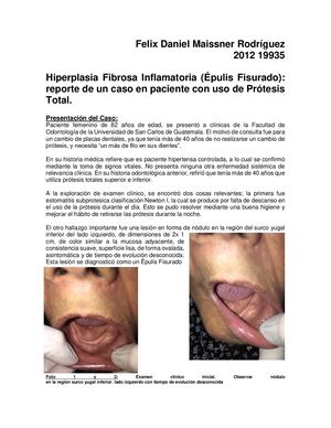 Epulis Fisurado Caso Clinico F Maissner