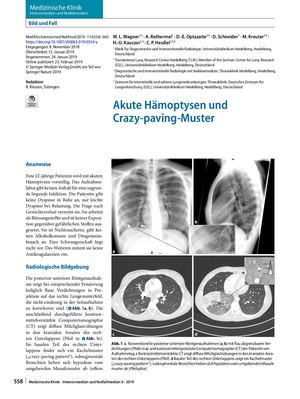 10 Akute Hämoptysen Und Crazy‑paving Muster