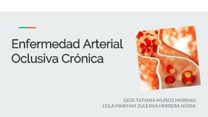 Enfermedad Arterial Oclusiva Crónica