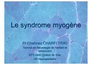 Sd Myopathique Et Myasthénique