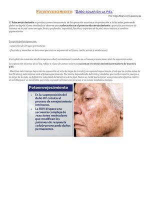 Fotoenvejecimiento Nota Concepto Estetico