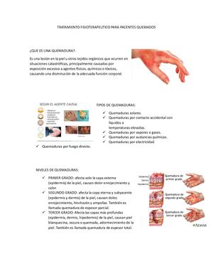 Tratamiento Fisioterapeutico Para Pacentes Quemados
