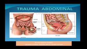 Trauma Abdominal Dr Demera
