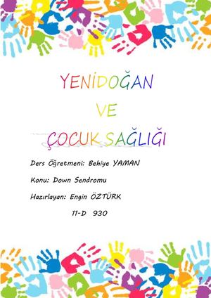 Down Sendromu