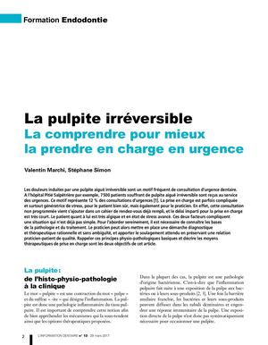 Pulpite Irréversible, la comprendre pour mieux la prendre en charge - Dr SIMON & MARCHI