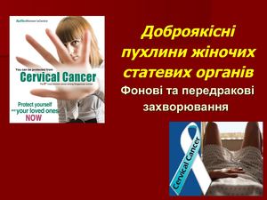 Доброякісні новоутворення жін стат орг