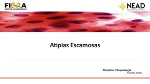 Aula 07 Nead Atipias (Asc) 2020 1