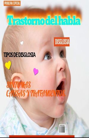 Revista Trastorno Del Habla Disglosia