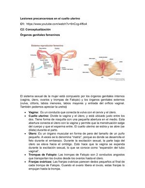 C1, C2, C3 Lesiones En El Cuello Uterino Dana Y Manu
