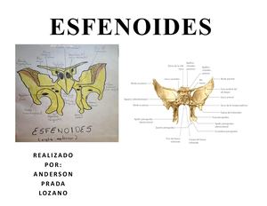 Esfenoides