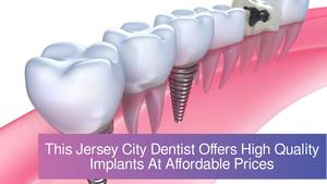 This Jersey City Dentist Offers High Quality Implants At Affordable Prices