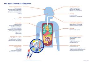 Condition Infectieuses Calaméo - 62B - Maladies infectieuses