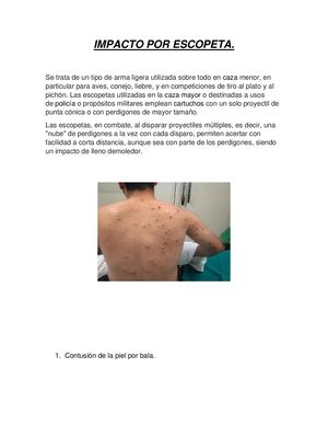 Impacto Por Escopeta