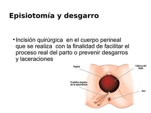Episiotomia Y Desgarro