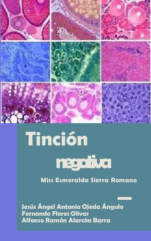 Tinción Negativaa
