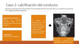 Caso 2 Sialolitasis 1
