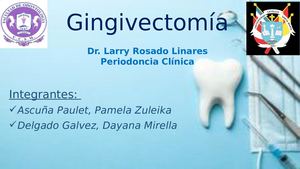 Gingivectomía Expo 1 Fase