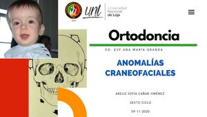 Diapositivas Anomalías Craneofaciales
