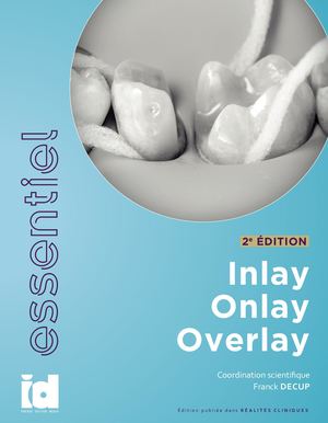 Inlay Onlay 2020 Preview